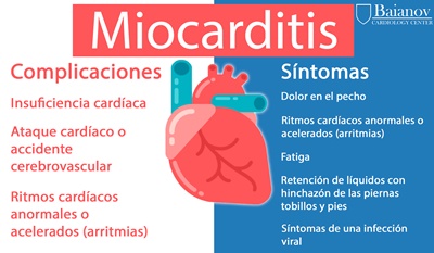 miocarditis